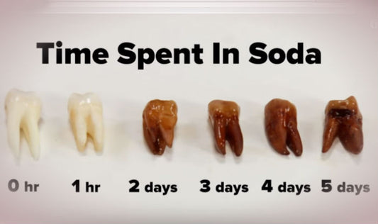 Soft Drinks + Oral Care: Tips For Reducing The Damage