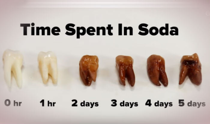Soft Drinks + Oral Care: Tips For Reducing The Damage
